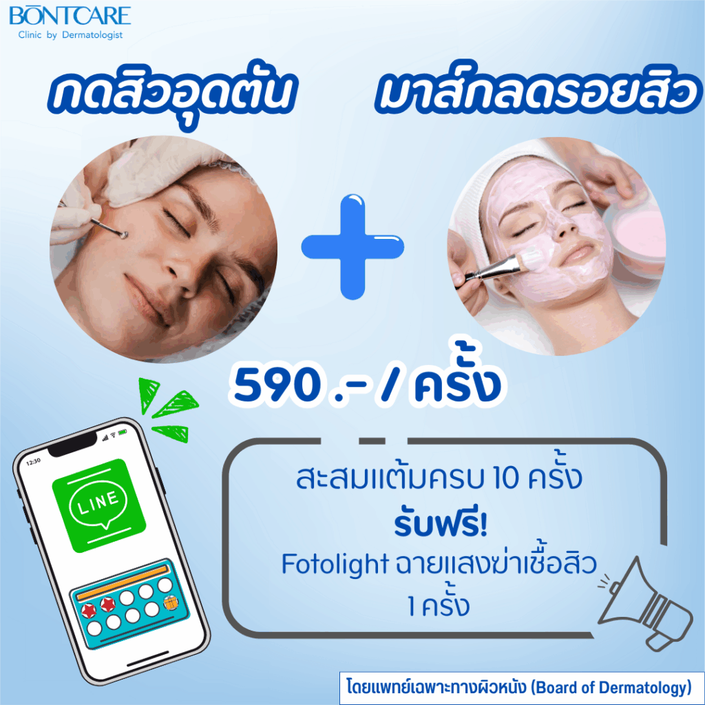 กดมาส์กสะสมแต้ม
