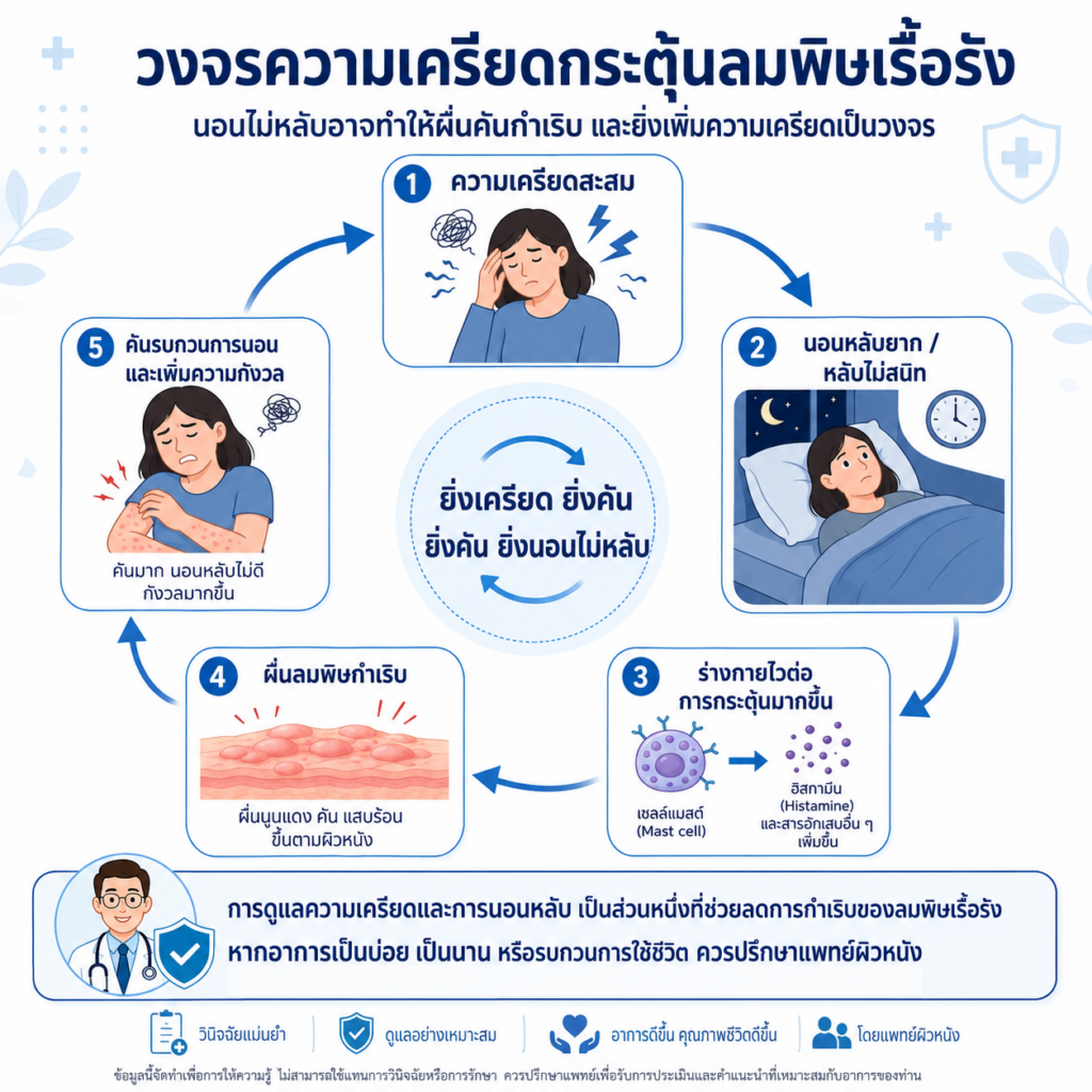 วงจรความเครียดกระตุ้นลมพิษเรื้อรัง นอนไม่หลับทำให้ผื่นคันกำเริบ