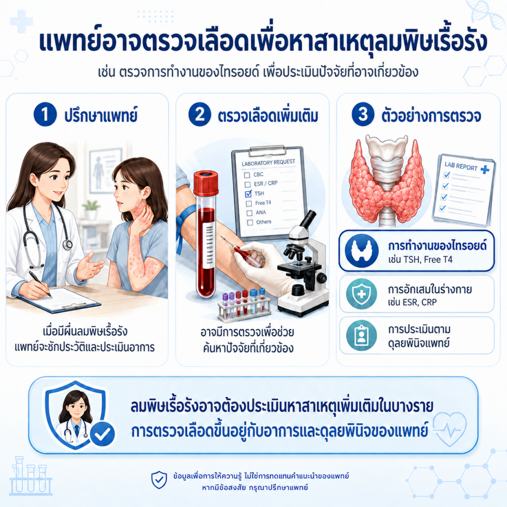 แพทย์ตรวจเลือดเพื่อหาสาเหตุลมพิษเรื้อรัง เช่น การทำงานของไทรอยด์