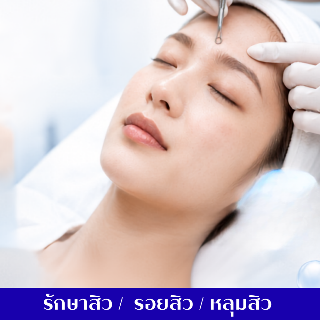รักษาสิวรอยสิวหลุมสิว