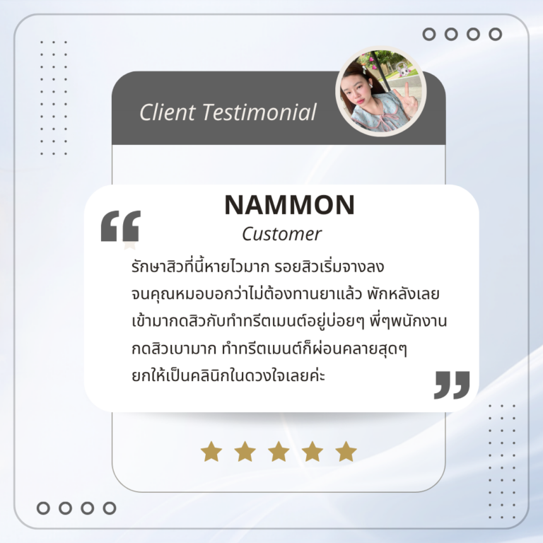 รีวิวรักษาสิว